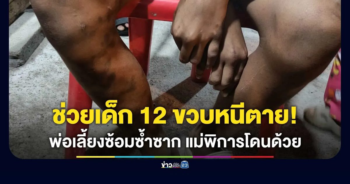 ยายทวดใจสลาย! ช่วยเหลนวัย 12 ปีหนีตาย ถูกพ่อเลี้ยงใช้ด้ามไม้กวาดตีฟกช้ำระบำ