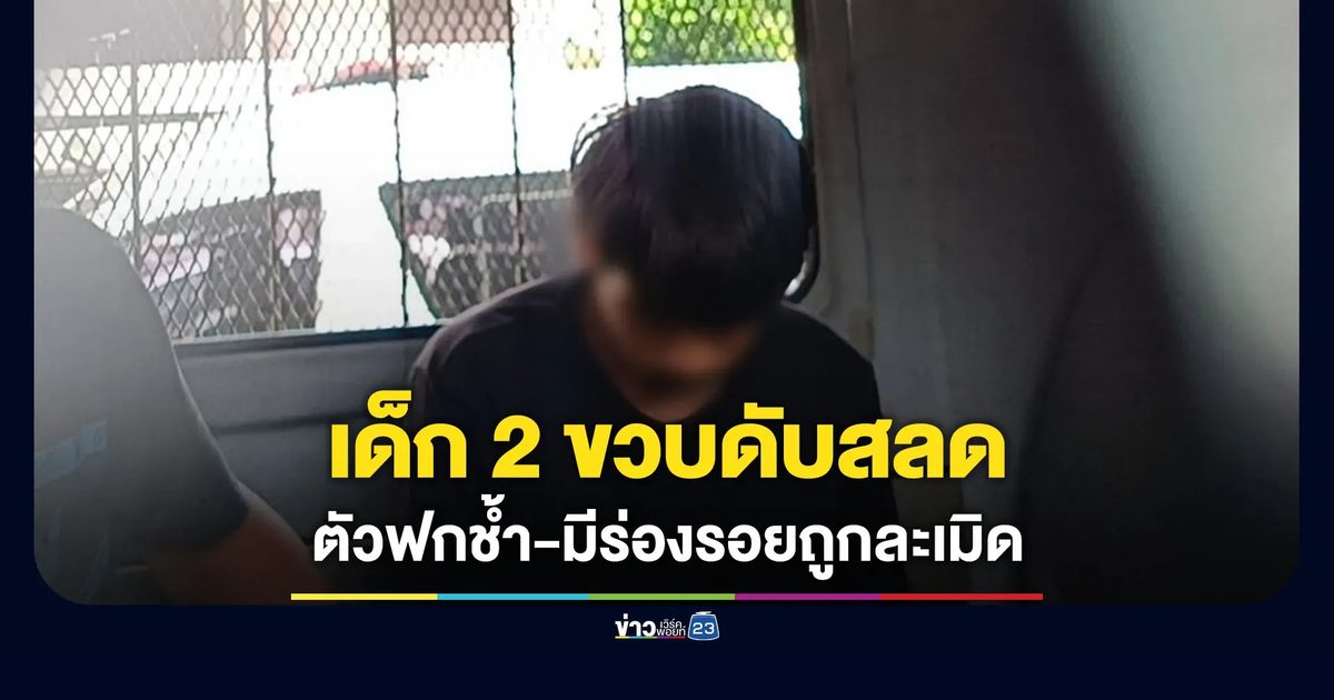 เด็ก 2 ขวบดับสลด ตามตัวฟกช้ำ-มีร่องรอยถูกละเมิด