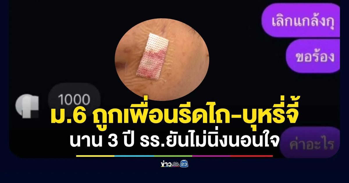 ขอนแก่นวิทยายน แถลงปมเด็กถูกกลั่นแกล้ง-ทำร้าย เร่งสอบข้อเท็จจริง