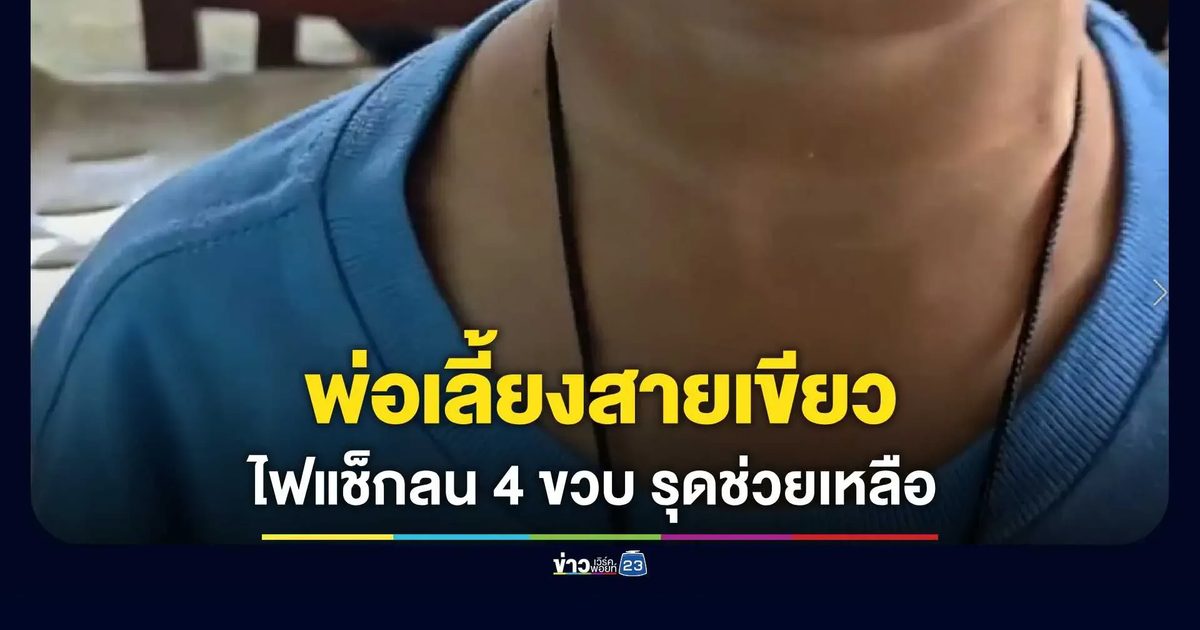 สลด! พ่อเลี้ยงสายเขียวเมาทารุณ ด.ช. 4 ขวบ เอาไฟแช็กลนร่าง พม.-เพจดัง รุดช่วย