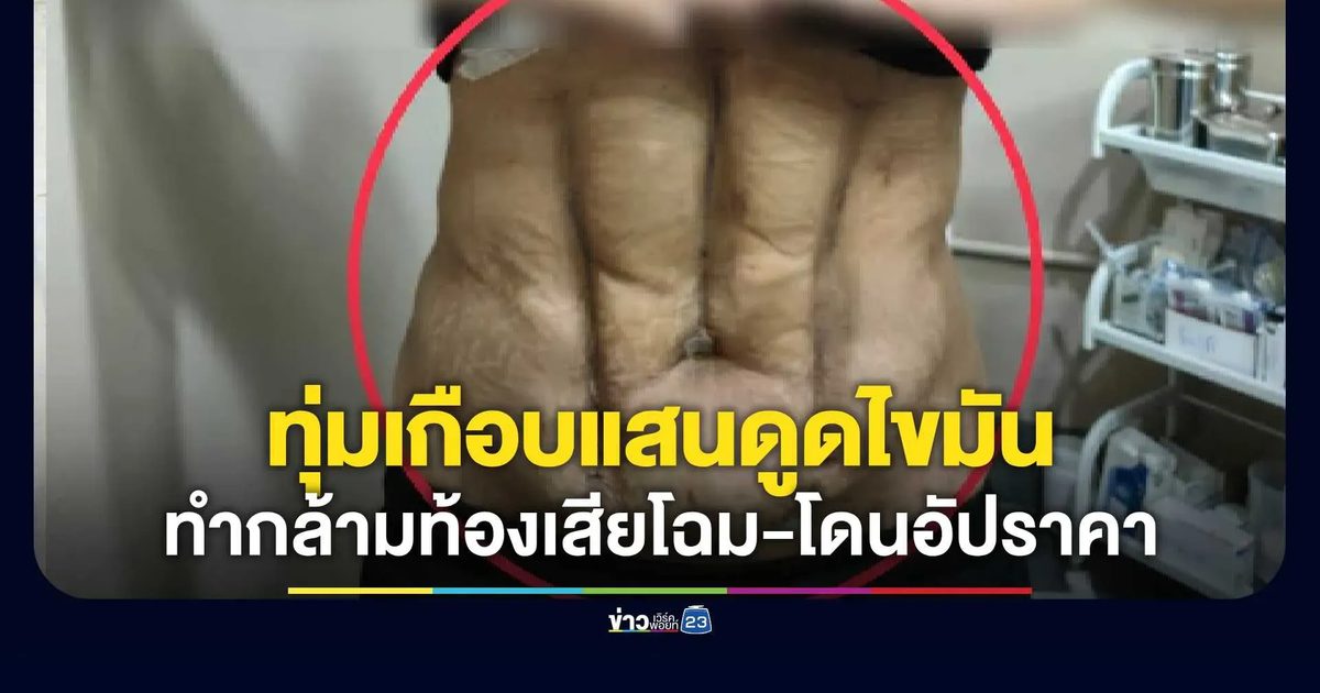 ร้อง “สายไหมต้องรอด” ทุ่มเกือบแสนดูดไขมันคลินิกดัง ผลออกมาท้องลายเบี้ยว-เป็นไต
