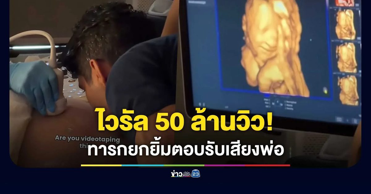 ไวรัล 50 ล้านวิว! ทารกยิ้มตอบรับเสียงพ่อ