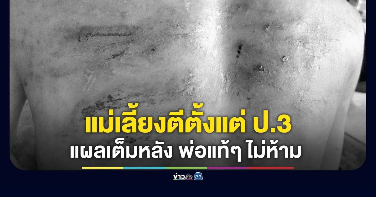 แม่เลี้ยงตีลูกเลี้ยงตั้งแต่ ป.3! แผลเต็มหลัง-อดข้าวทรมาน พ่อแท้ๆ ไม่ห้าม