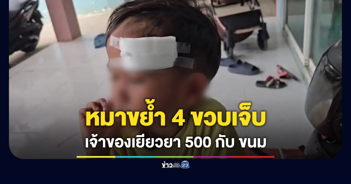 เด็ก 4 ขวบโดนหมาขย้ำหัวเจ็บ เจ้าของหมาเยียวยา 500 กับขนม