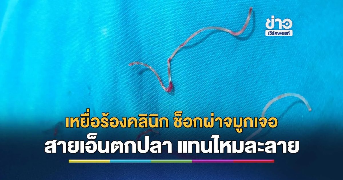 จมูกเกือบเน่า! เหยื่อร้องคลินิกดังพัทลุง ช็อกผ่าจมูกเจอตะลึง "สายเอ็นตกปลา" ยัดแทนไหมละลาย