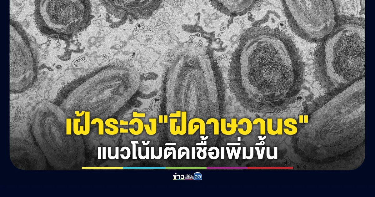 เฝ้าระวัง!"ฝีดาษวานร"พบแนวโน้มติดเชื้อเพิ่มขึ้น