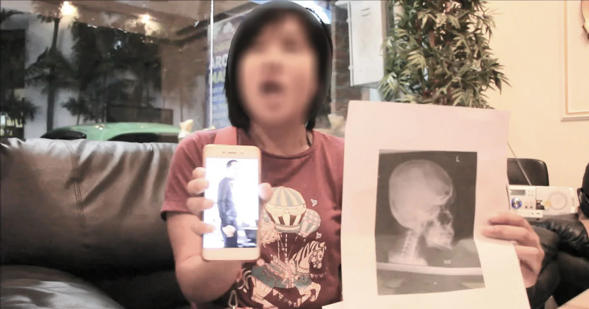 คืบหน้า ! ‘เเคดดี้สาว’ ร้องสื่อ ถูก ‘ดาบตำรวจ’ ตบจนฟันกรามหัก คาโรงพัก