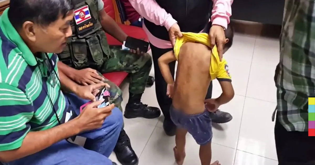 สลด ! แม่เฆี่ยนตีลูกวัย 4 ขวบเยี่ยงทาส ครูประจำชั้นเข้าช่วยเหลือ