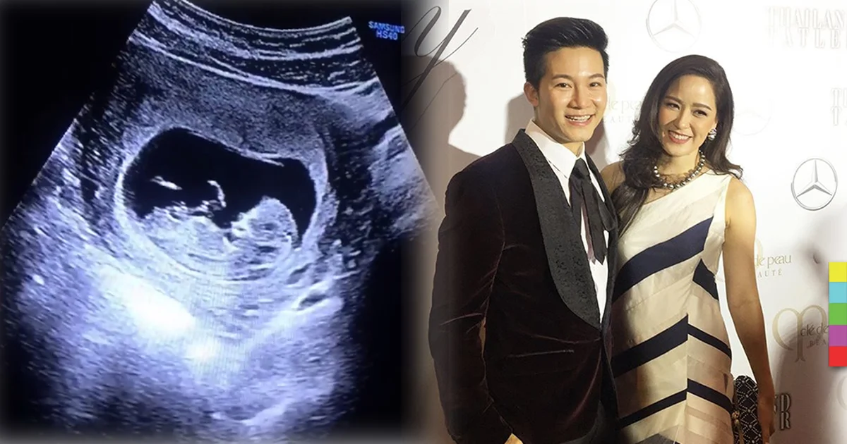 “อั๋น ภูวนาท” เตรียมเป็นคุณพ่อ “จ๋า” ภรรยาสุดสวย ตั้งท้อง 3 เดือน