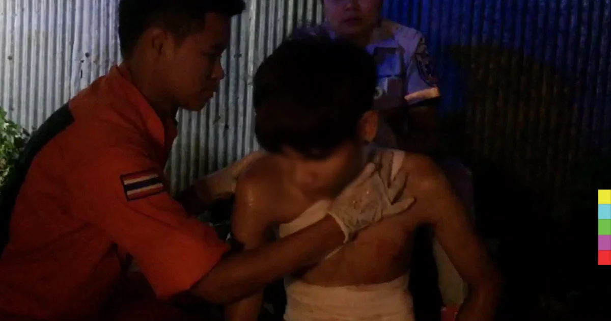 ‘หนุ่มเมียนมา’ หนีตาย หลังถูกไล่ฟันแทงท้องทะลุ !
