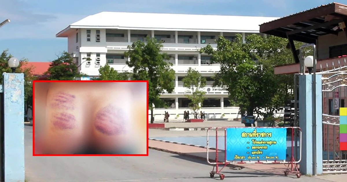 ลงโทษเด็ก 12 ก้นช้ำเลือด ผู้ปกครองถาม “เกินกว่าเหตุหรือไม่”