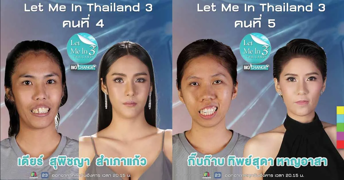 เปิดใจ “เดียร์-กิ๊บก๊าบ” หลังพลิกชีวิตใน Let me in Thailand 3