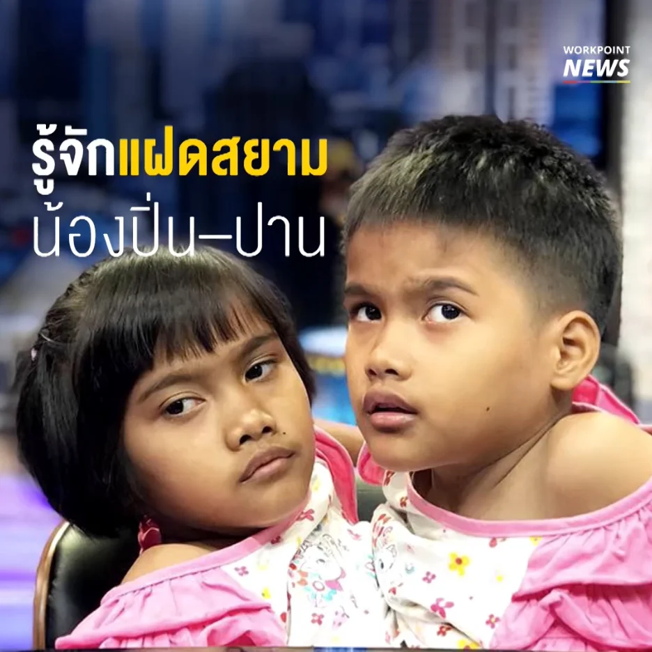 รู้จักแฝดสยามน้องปิ่น-น้องปาน
