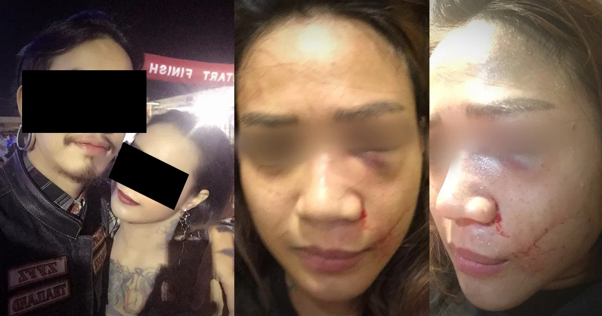 สุดช้ำ ! สาวไลฟ์สดแฉโดนแฟนซ้อมจนตาปูด เหตุแค่โยนบุหรี่ไฟฟ้าทิ้ง