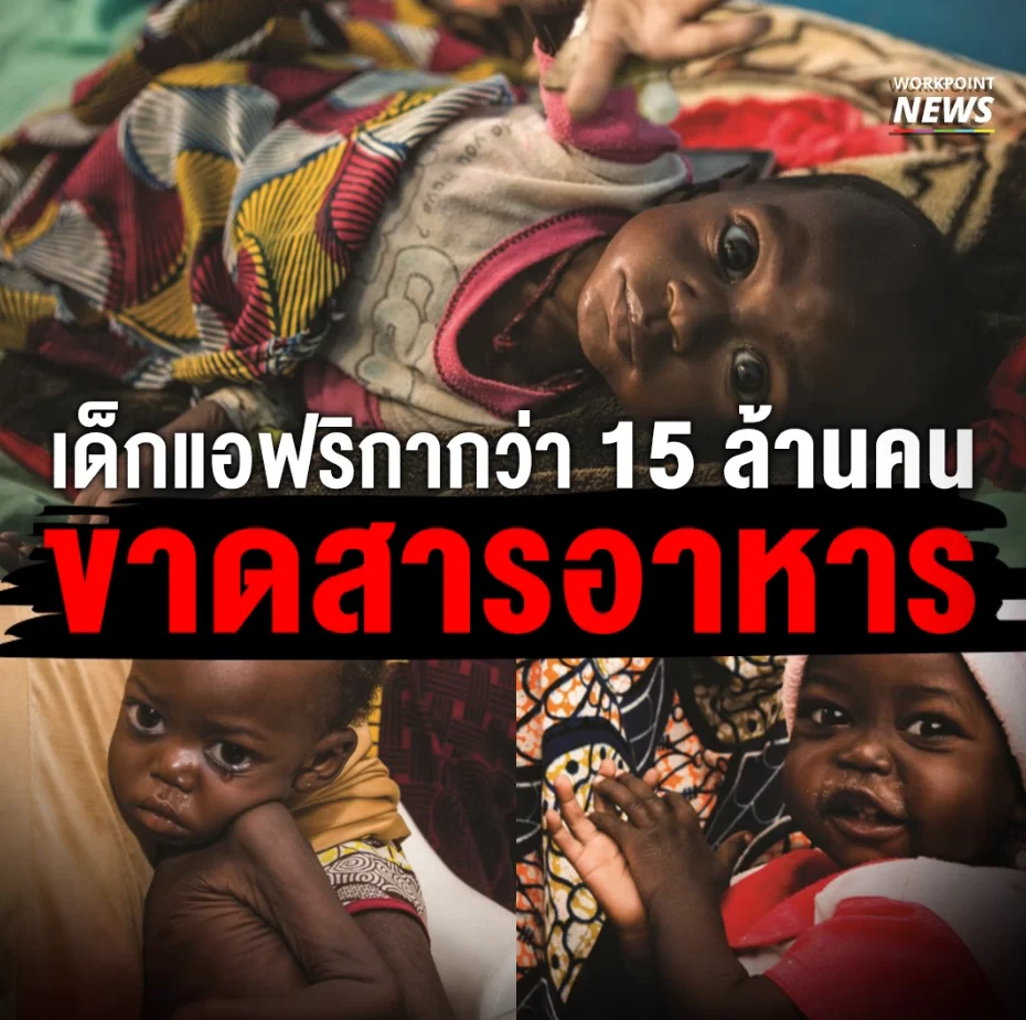 เด็กแอฟริกา 15 ล้านคน ขาดสารอาหาร