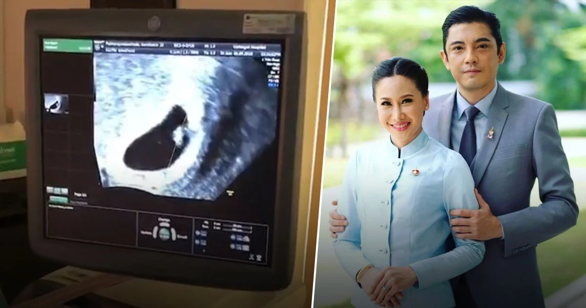 ชัดเจน ! “ศรราม” เผยภาพลูกในท้อง เตรียมตัวเป็นคุณพ่อป้ายแดง