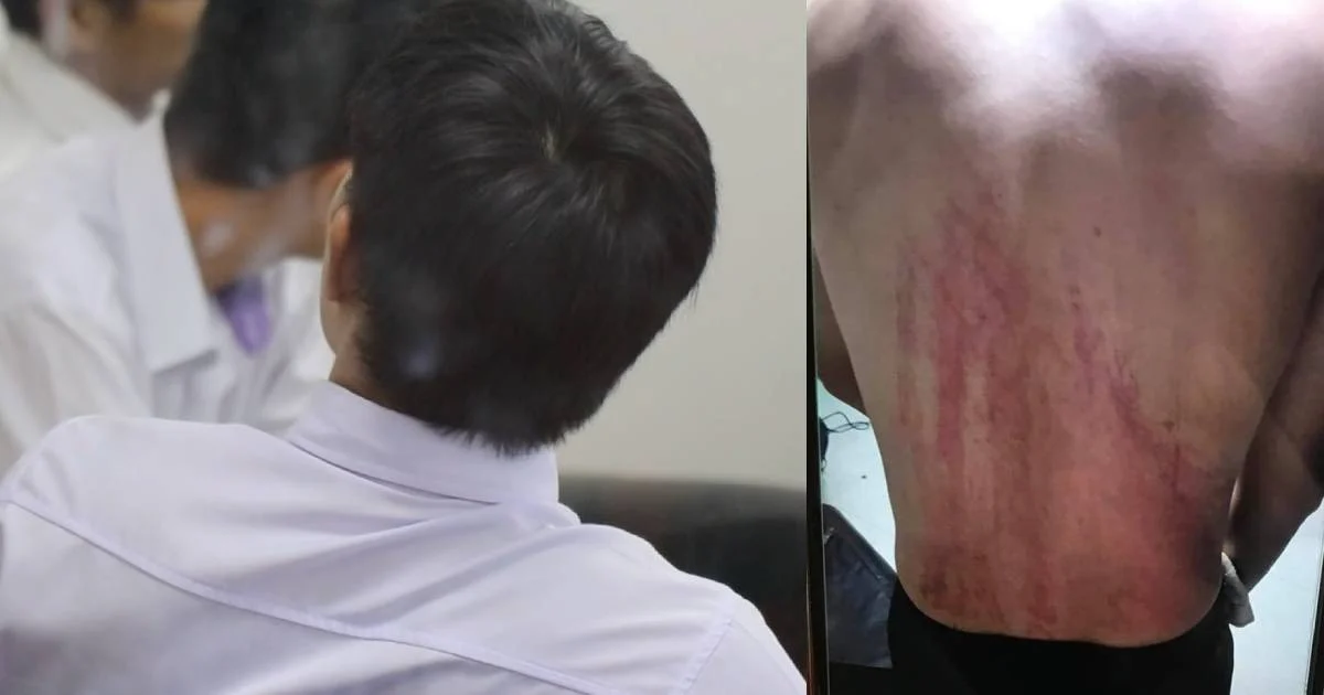 รุ่นพี่แม่โจ้ สารภาพแล้วทำร้ายรุ่นน้องจริง อ้างกลัวกระทบการเรียน-สถาบันเลยรับช้า