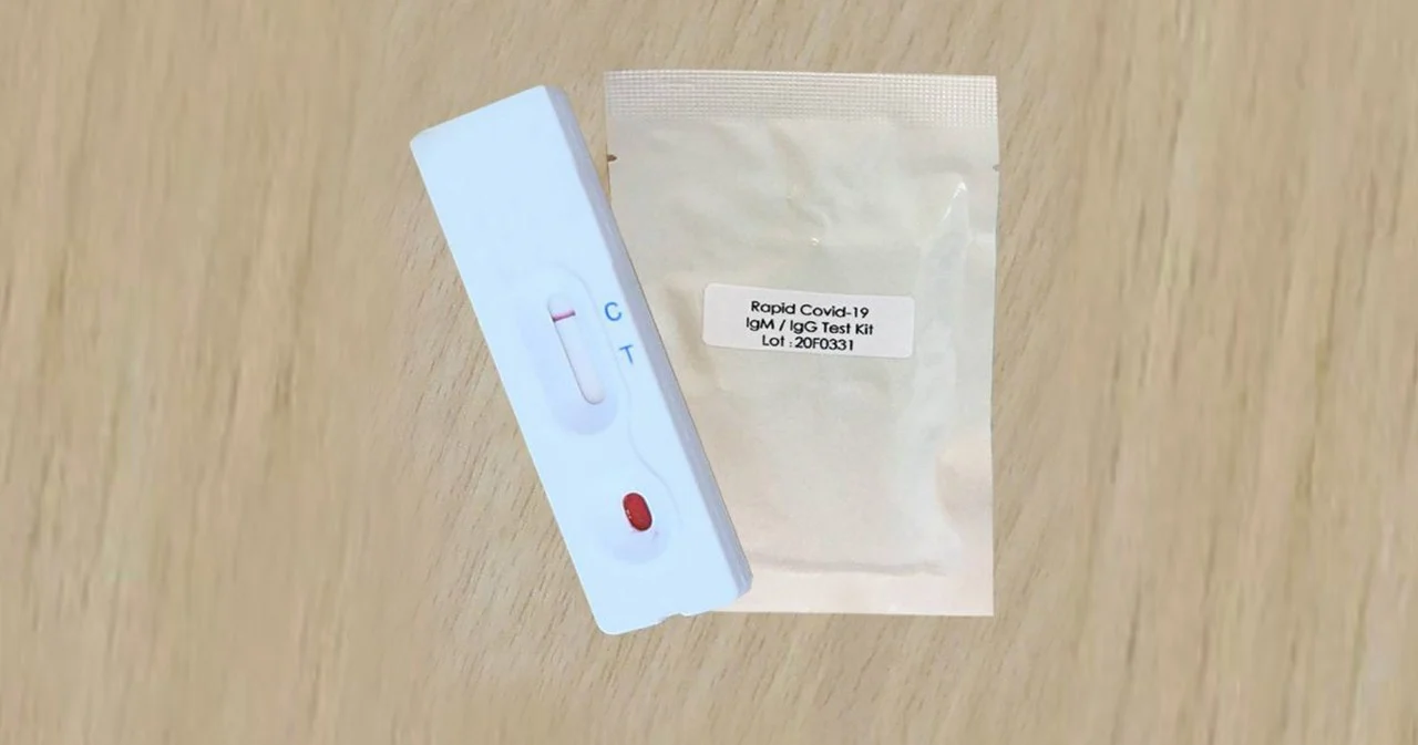 จุฬาฯ คิดค้นชุดตรวจ Chula COVID-19 Strip Test เริ่มใช้ 30 มี.ค.นี้