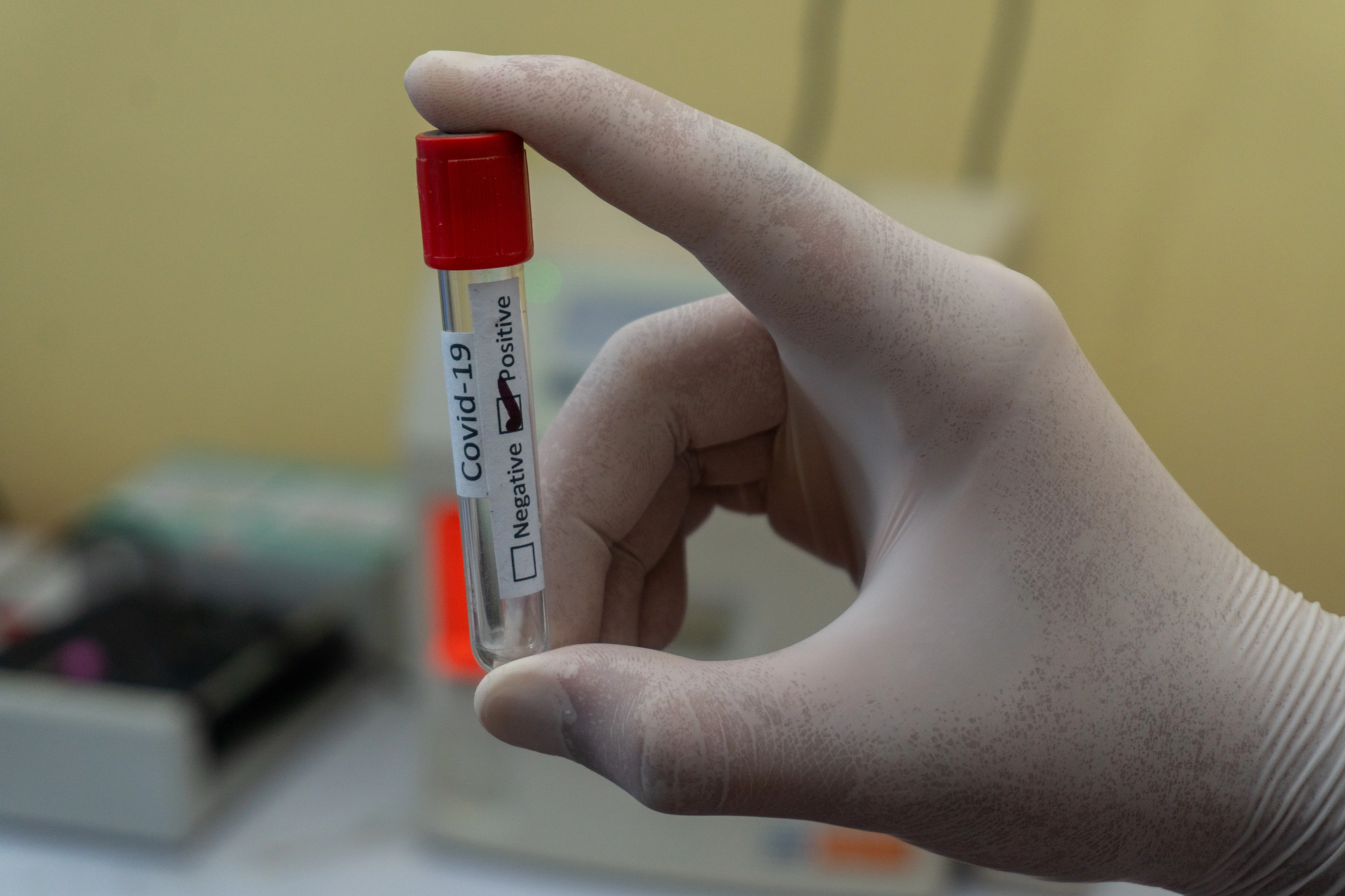 ยกเลิกตรวจโควิด-19 แบบ RT-PCR ก่อนเข้าไทย 72 ชม. ทุกกลุ่ม